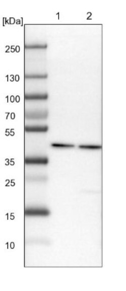 HPD Antibody, Novus Biologicals 0.1mL; Unlabeled:Antibodies, Polyclonal
